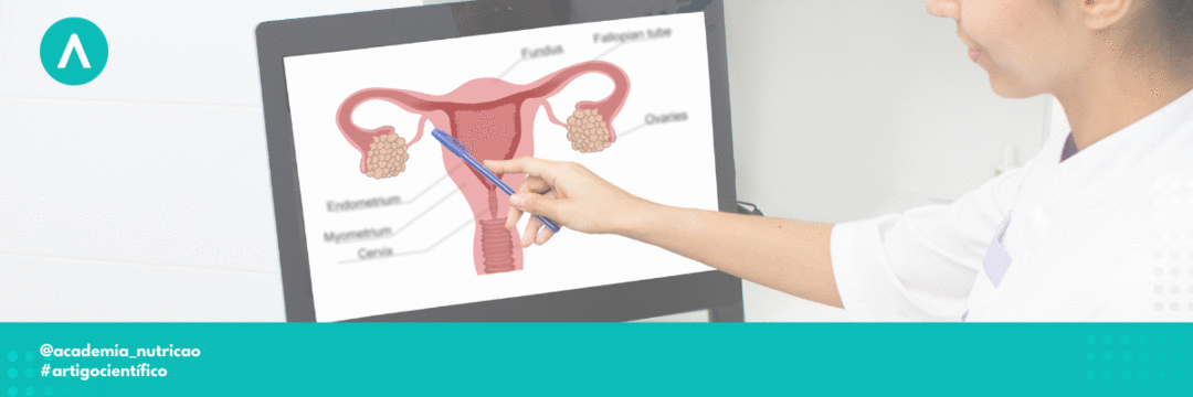 Entenda o papel da nutrição na prevenção e tratamento da endometriose
