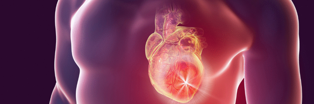 Doenças cardiovasculares: o que você precisa saber sobre escore de risco